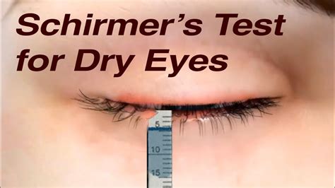 4 tear test|schirmer test without anesthesia.